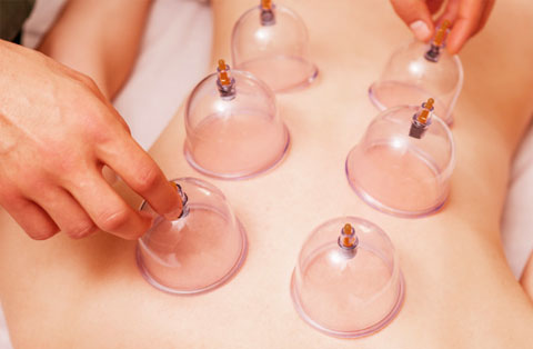 Massage Cupping